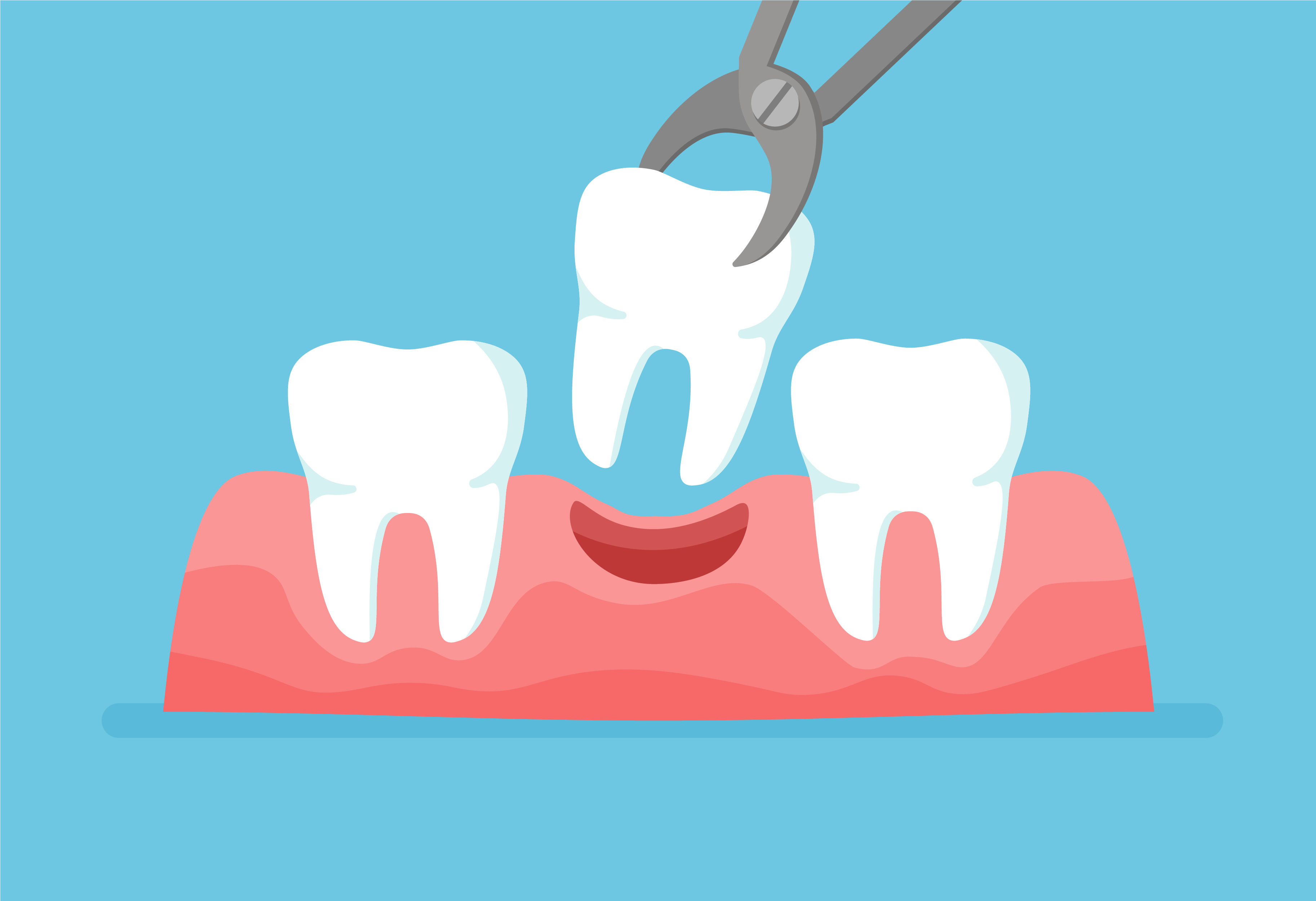 Dental Hospital For Tooth Extraction